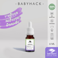 TESTER - SKIN EARTH BABYHACK BAKUCHIOL X Q10 10ML [สกิน เอิร์ธ เบบี้แฮ็ค บาคุชิออล x คิวเท็น]