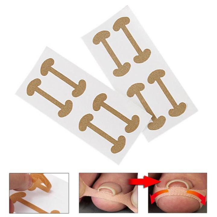 48pcs-professional-embedded-toe-nail-corrector-nail-treatment-elastic-patch-thumb-curl-correction-sticker-tool-care-tool