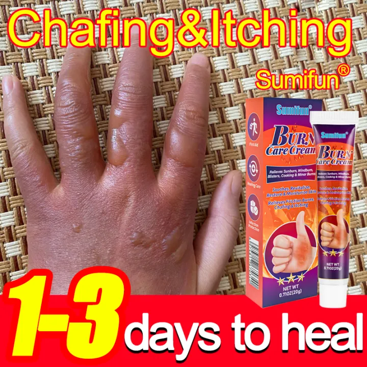 Recover In a Day!!! Sumifun Burn cream Skin burn ointment 20g Nursing