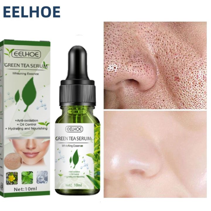 beautyiu-eelhoe-10ml-green-tea-oil-control-pore-shrink-face-serum-whitening-remove-dark-spots-improve-acne-blackheads-dry-skin-care-เครื่องสำอางเกาหลี