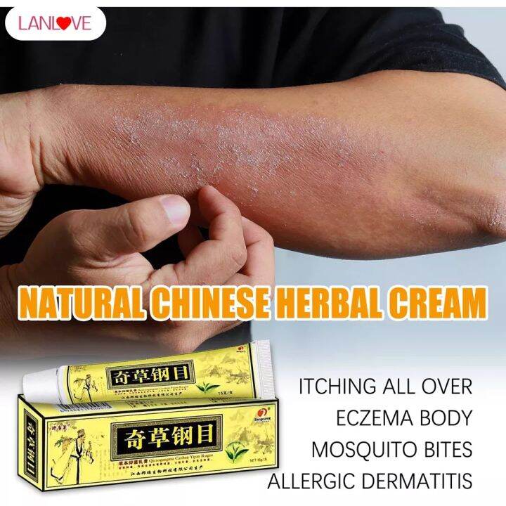 Herbal Psoriasis Cream Quick Relief Itching Dermovate Eczema Ringworm
