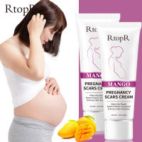 RtopR 2PCS FDA รอยแตกลายมะม่วง ครีมบํารุงผิว ลดรอยแผลเป็น ครีมทาท้องลาย ลดรอยแตกลาย ท้องลาย ริ้วรอยจากการตั้งครรภ์ - Stretch Mark Cream 40 กรัม