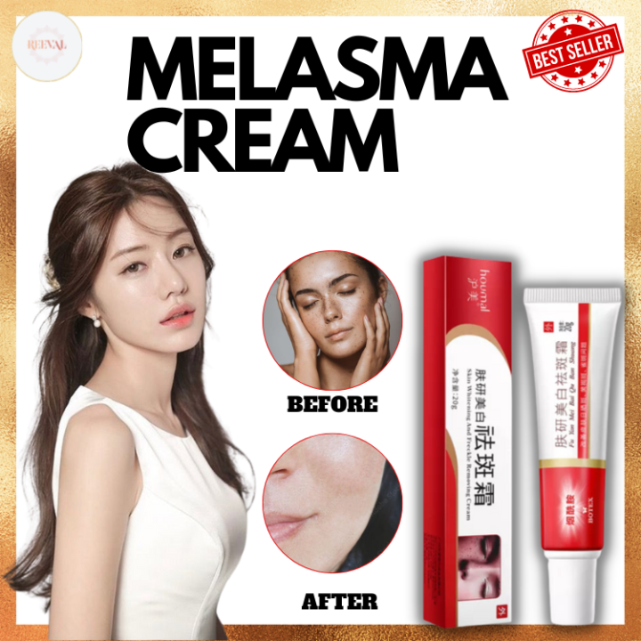 Melasma Cream Pekas Remover Collagen Japan Original Pekas Remover Cream