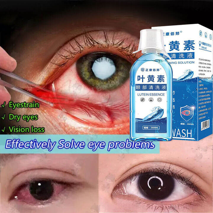 Japan Eyewash Eyewash Eye Lotion Ophthacare Eye Drops To Keep Your Eyes 