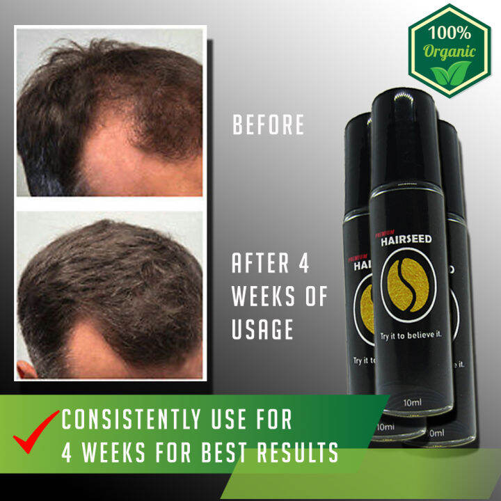 NEW AND IMPROVED HAIRSEED Hair Grower for Men and Women , hair grower ...