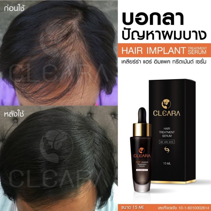 ส่งฟรี-cleara-สเปร์บำรุงรากผม-2-ขวด-ของแถม-บอกลาหัวล้าน-ผมบาง-ผมหนาขึ้น-บำรุงเส้นผม-รากผมแข็งแรงขึ้น-ลดการหลุดร่วง-50ml-เคลียร์ร่า