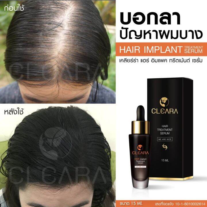 ส่งฟรี-cleara-เคลียร่า-เซรั่มปลูกผม-กระตุ้นรากผม-ผมหลุดร่วง-ผมดก-ดำ-ปลูกหนวด-ปลูกคิ้ว-ขนาด-15-ml