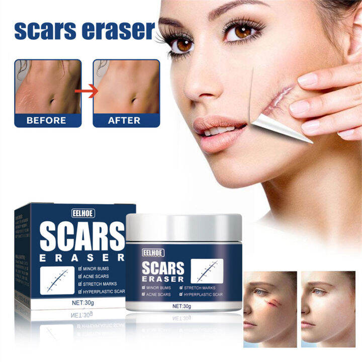 EELHOE Desalination Scar Cream Skin Scar Gel Cream Cold Paste Burn