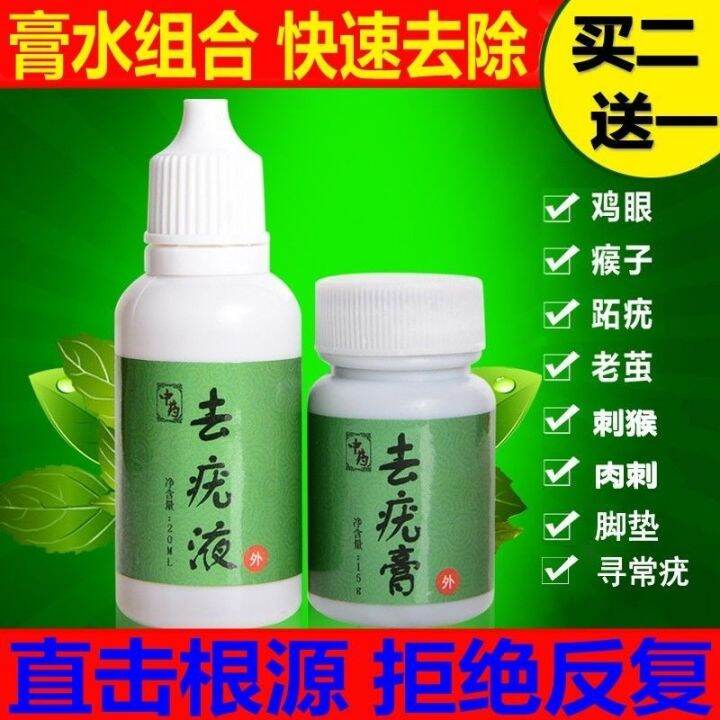 Plantar wart ointment corn medicine to remove hand and foot meat thorns monkey toe callus pad