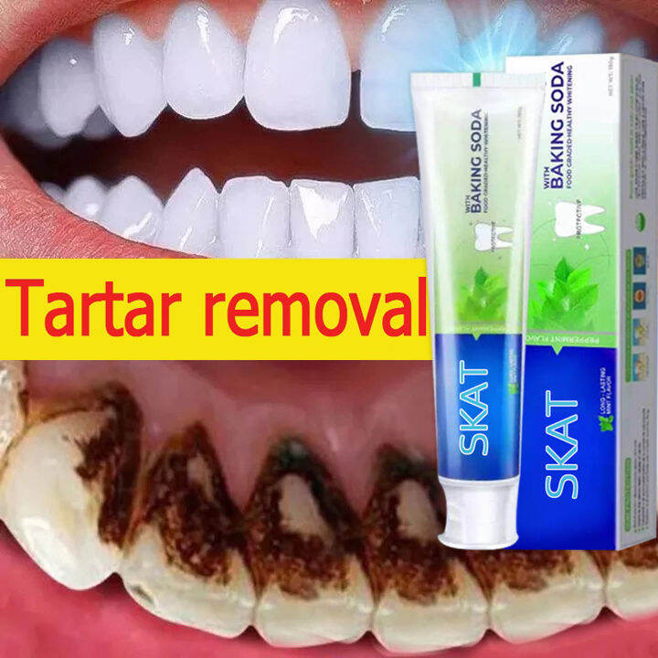SKAT BAKING SODA Whitening Toothpaste Remove Plaque Stains Oral Odor