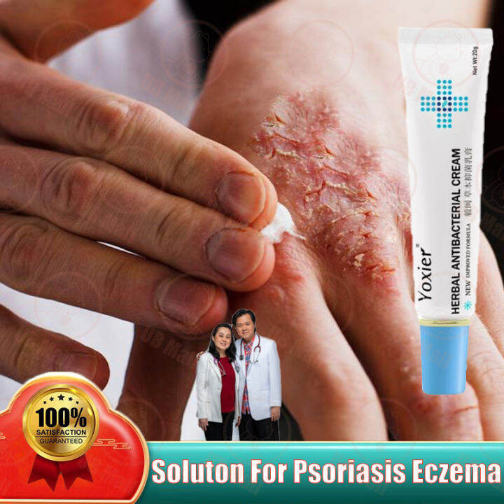 Yoxier Herbal Antibacterial Cream Treatment Rashes Fungal Dermatitis