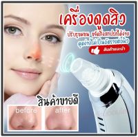 เครื่องดูดสิวเสี้ยน KM-1867 อุปกรณ์ดูดสิวเสี้ยน กำจัดสิวเสี้ยนจมูก ดูดสิวที่จมูก แรง 3 ระดับ/ เครื่องล้างหน้าแบบซิลิโคลน