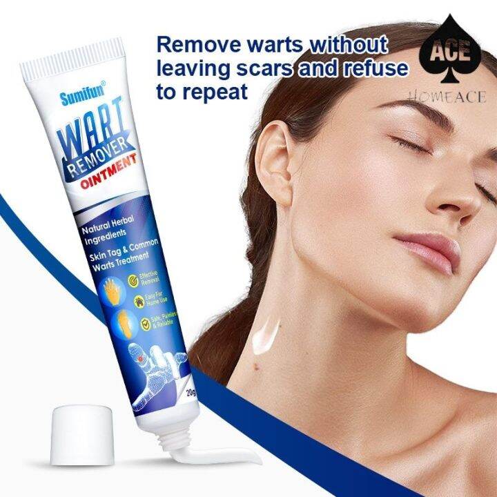 HomeAce Warts Remover Kasoy Oil Warts Remover Warts And Skin Tags ...