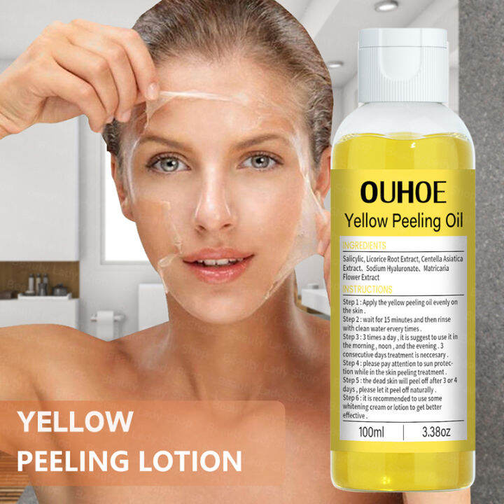 100 Original Effective Yellow Peeling Oil 100ml Peeling Lotion Body