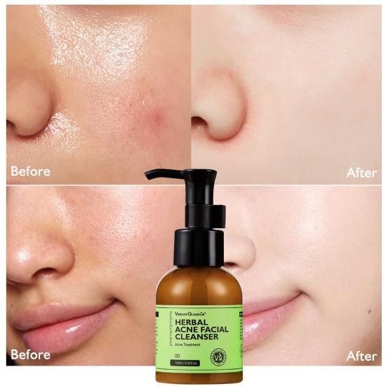 Vibrant glamour sữa rửa mặt herbal acne làm sạch sâu da dưỡng ẩm 100ml sữa - ảnh sản phẩm 6