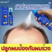 บอกลาหัวล้าน EELHOE สเปรย์ปลูกผม เร่งผมขึ้นใหม่ เร่งผมยาวไว ป้องกันผมร่วง ป้องกันผมร่วงอย่างมืออาชีพ แก้ปัญหาผมร่วง ลดผมร่วง(น้ำยาใส่ผม ยาปลูกผม น้ำยาปลูกผม น้ำยาเร่งผมยาว เซรั่มปลูกผม ปลูกผมเร่งด่วน ปลูกผม ยาปลูกผมผู้ชาย ยาปลูกผมหญิง ยาปลูกผมของแท้ )