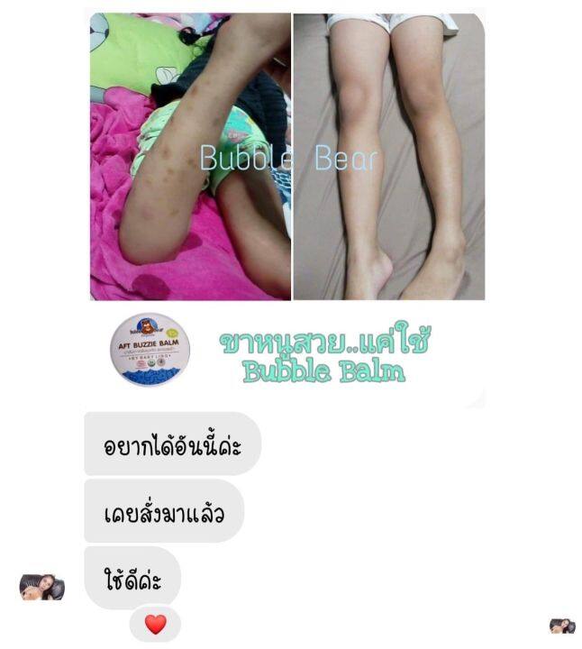 บาล์มทาหลังยุงกัด-ลดรอยดำ