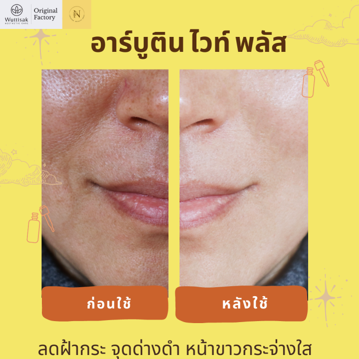 ครีมทาฝ้า-arbutin-white-plus-วุฒิศักดิ์-เอสเธติค-แคร์-อาร์บูติน-ไวท์-พลัส-10-กรัม-เหมาะกับผู้ที่มีปัญหาฝ้า-กระ-จุดด่างดำ