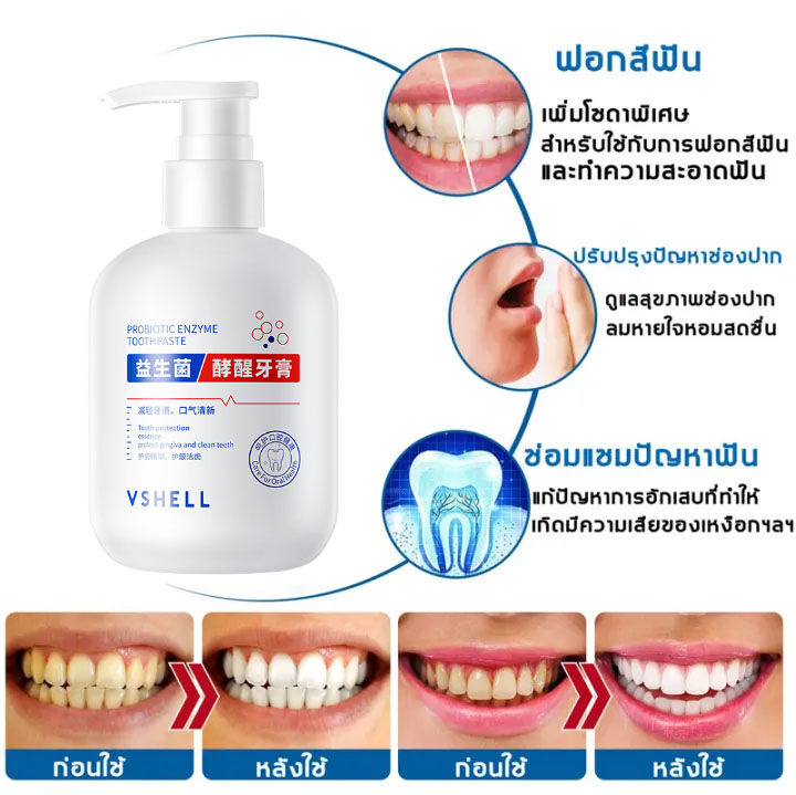 บอกลาฟันเหลือง-vshell-ยาสีฟันฟันขาว-น้ำยาขัดฟันขาว-ฟอกฟันขาว-ฟันขาว-ยาสีฟันฟอกขาว-ยาสีฟันขาว-ฟอกสีฟันขาว-ฟันเหลือง-น้ำยาฟอกฟันขาว-แก้ฟันเหลือง-ที่ขัดฟันขาว-ฟันขาว-ฟอกสีฟัน-ยาสีฟันขจัดปูน-ยาฟอกฟันขาว-ย