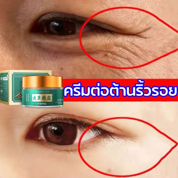 การส่งมอบกรุงเทพฯ-อายครีมบำรุงตา-ครีมลดถุงใต้ตา-ลดถุงใต้ตา-ที่มาร์คใต้ตา-ขอบตาดำ-มาคใต้ตา-ลบถุงใต้ตา-ครีมทาถุงใต้ตา-ครีมลบถุงใต้ตา-อายครีม-ครีมบำรุงรอบตา-ครีมลบใต้ตาดำ-ครีมทารอบดวงตา-ครีมแก้ขอบตาดำ-ey