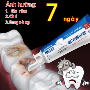 Kem đánh răng Probiotic loại bỏ hôi miệng Helicobacter flavus sâu răng làm