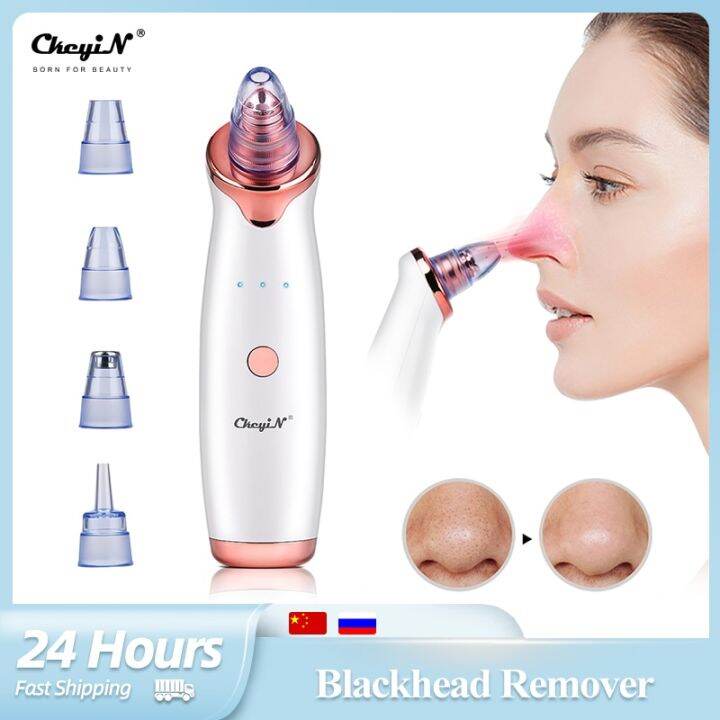 Ckeyin Electric Blackhead Remover Vacuum Acne Cleaner Pimple Pore