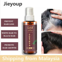 White Hair Blackening Anti-Hair Loss Spray 100ml เอสเซ้นส์สมุนไพรพฤกษศาสตร์ ย้อมผมสีดำ ผลติดทนนาน ไม่เป็นอันตรายและไม่ระคายเคือง