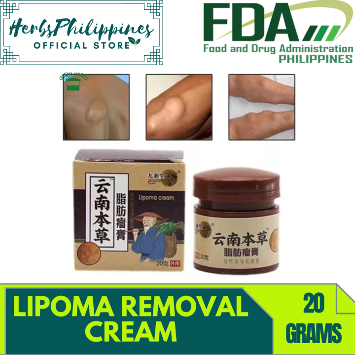 20g Lipoma Removal Herbal Ointment Tumor Treatment Multiple Anti Tumor