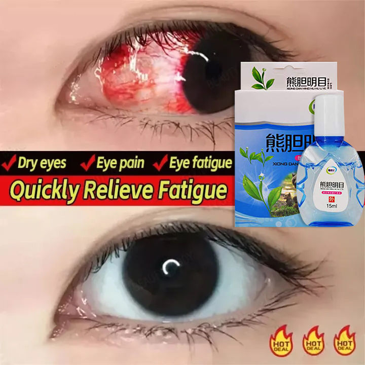 🔥100% Original🔥eye drops, dry eyes, bloodshot eyes, blurred eyes, red ...