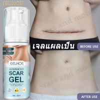 EELHOEลดแผลเป็นอย่างรวดเร็ว 50ml ครีมลดรอยแผลเป็น ลดแผลเป็นไฟไหม้ แผลน้ำร้อนลวก แผลผ่าตัดเป็นต้น. ครีมลบแผลเป็นยาทาแผลเป็นนูนเจลลบรอยแผลเป็นครีมทาแผลเป็นครีมลบรอยแผลเป็นครีมแผลผ่าตัดครีมลดแผลเป็นแผลเป็นครีมบำรุงหน้าลบรอยแผลเปน Scar cream