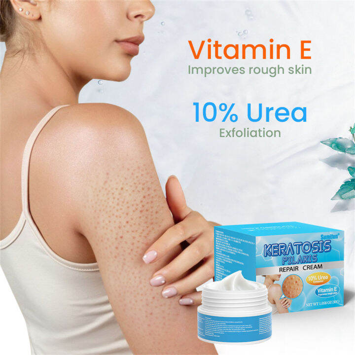 30g Keratosis Pilaris Lotion Fast Effective Relief Restoring Body