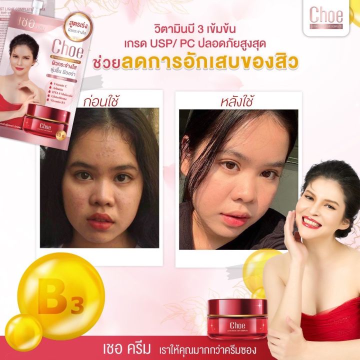 โปร-20-แถม-2-choe-cream-เชอ-ครีม-ผิวกระจ่างใส-ชุ่มชื่น-มีออร่า-ฉ่ำ-โกลว์-แบบเกาหลี