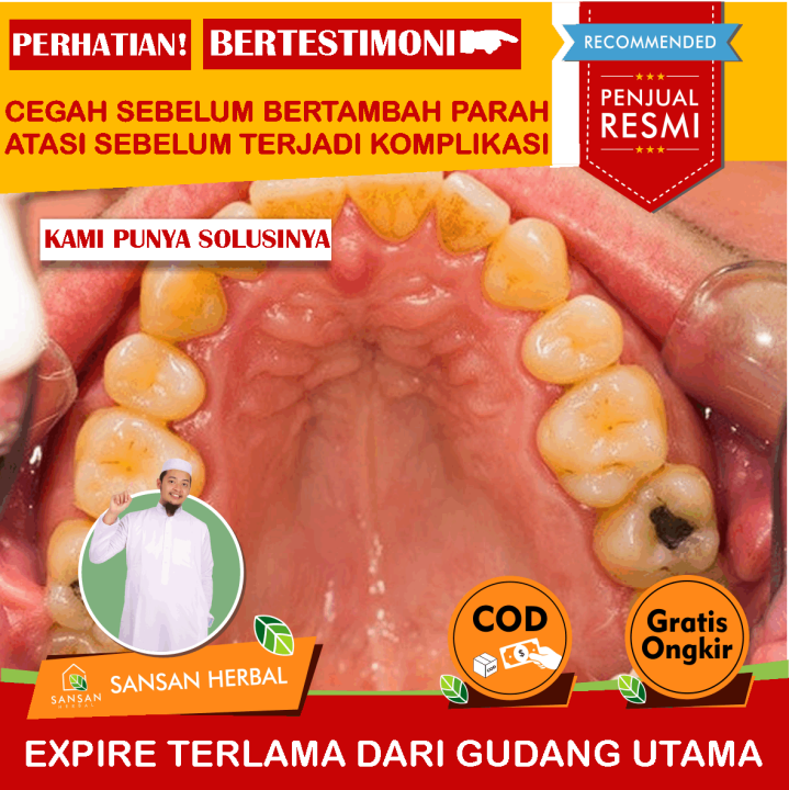 Obat Sakit Gigi, Obat Sakit Gigi Berlubang, Obat Tetes Sakit Gigi