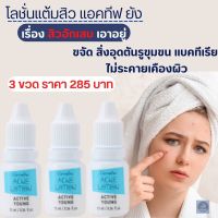 #ส่งฟรี #โลชั่นสิวอักเสบ #กิฟฟารีน #โลชั่นแต้มสิว #แอคทีฟยัง #สิว #ยับยั้งแบคทีเรีย #ขจัดสิ่งอุดตันรูขุมขน #กิฟฟารีนแท้ #AcneLotion Active Young Giffari#