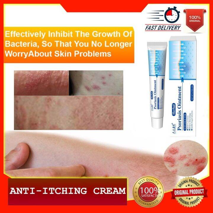 Skin Antibacterial And Anti-itch Cream Psoriasis Cream Eczema Cream ...