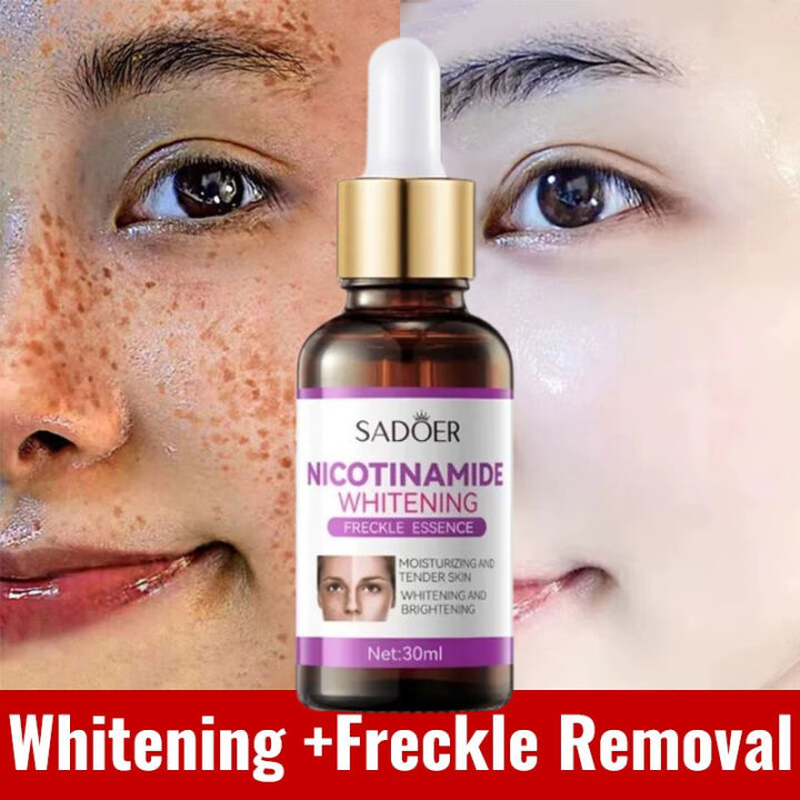 SADOER Nicotinamide Whitening Freckle Serum Melasma And Pekas Remover Serum Original Niacinamide