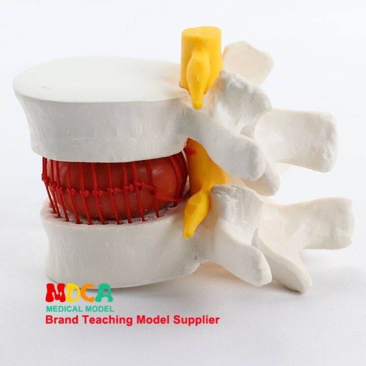 lumbar-disc-medical-massage-lumbar-spine-model-demonstration-model-equipment-medical-teaching