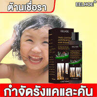 EELHOE แชมพูขจัดรังแค 100ml กำจัดรังแคและคัน ต้านเชื่อรา Shampoo Dandruff Shampoo แชมพูขจัดรังแค แชมพูสูตรขจัดรังแค