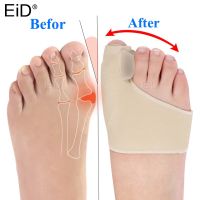 EiD 1Pair Big Bone Orthopedic Bunion Correction Pedicure Socks Silicone Hallux Valgus Corrector Braces Toes Separator Feet Care