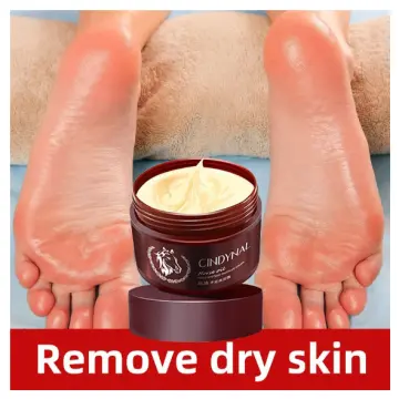 Dead Skin Removal Foot Care Cracked Heel Cream for Dry Skin - China  Cosmetics and Skin Care price | Made-in-China.com