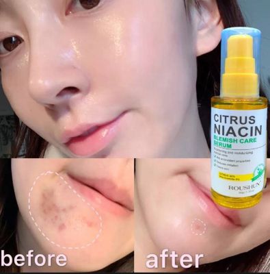 Roushun Citrus Niacin Blemish Care Serum 50g. บำรุงหน้า กระจ่างใส**ของแท้ พร้อมส่ง