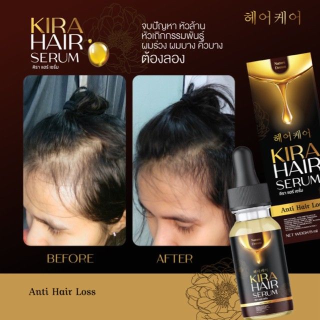 คิรา-แฮร์-เซรั่ม-1แถม1ส่งฟรี-kira-hair-serum-ปัญหาผมร่วงที่แก้ยาก-ครบ-จบ-ในขวดเดียว-แก้ปัญหา-ผมร่วง-ผมบาง-ผมหงอก-คิราแฮร์-แฮร์เซรั่ม