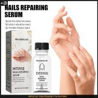 Intense Nail Growth and Strengthening Serum Nail Fungal Removal Liquid 3 Pcs 20ml Nail Repair Fluid Damaged Discolored Fingernail Strengthened Solution Fast Growing Strong