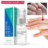 จัดส่งทันที น้ำยาแก้เล็บเสีย  AuQuest น้ำยาทาเล็บ  น้ำยารักษาเล็บ 20ml    เซรั่มทาเล็บเสีย  ยาทาเชื้อราที่เล็บ   ทำให้เล็บดีขึ้น  ยาทาแก้เชื้อราที่เล็บ  เล็บมือ เล็บเท้าใช้ได้หมด   เล็บเกิดใหม่สวยเหมือนเดิม  ช่วยลดเชื้อราที่เล็บมือ