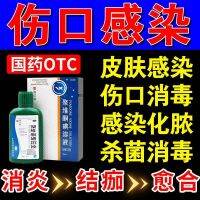 External liniment anti-inflammatory drug smear for external wound infection povidone-iodine solution bactericidal