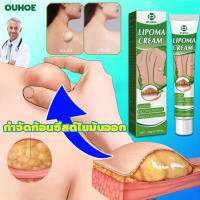 แท้OUHOE ออกแบบ36ชนิดของไขมันใต้ผิวหนังกำจัดมวลก้อนไปยังถุงน้ำ Lymph Care Ointment สมุนไพรกำจัด ก้อนเนื้อใต้ผิวหนัง ก้อนซีสต์ ก้อนไขมัน ครีมทาซีส ก้อนไขมัน ครีมระบายน้ำเหลือง ครีมน้ำเหลืองแบบอ่อนโยน ครีมบวมคอ ต่อมน้ำเหลืองบริเวณรักแร้ พร้อมส่งทั่ว