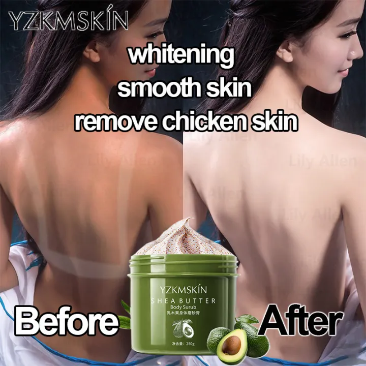Chicken Skin Treatment/Bleaching Whipped Scrub/Exfoliating Scrub Lazada PH