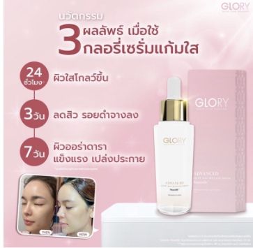 ส่งฟรี-เซรั่มกลอรี่-เซรั่มแก้มใส-glory-serum-pauseile-ลดรอยสิว-จางไวมาก-สิว-ปรับผิวเนียน-ขาวใส