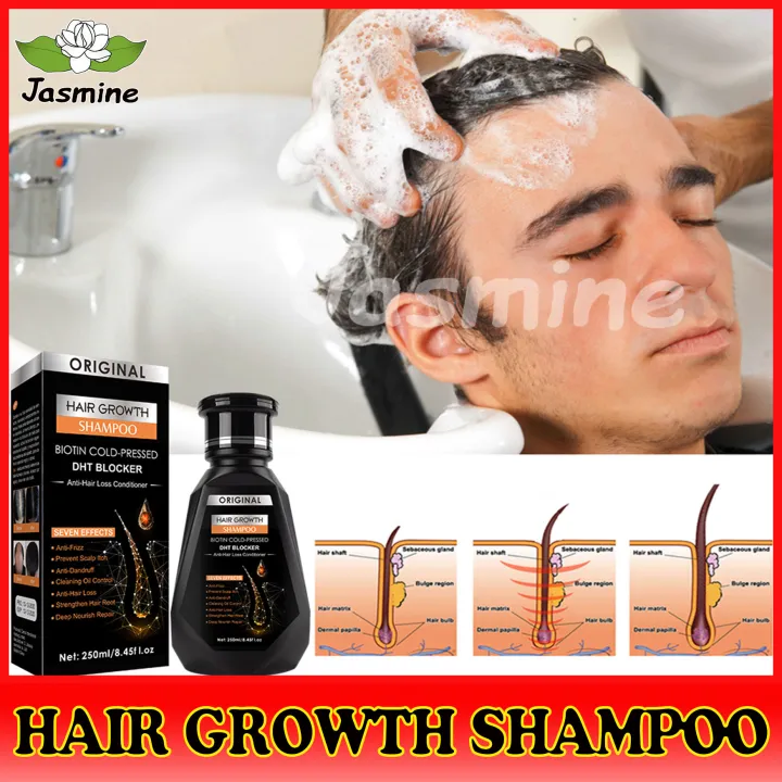 Hair growth shampoo,Prevent hair loss shampoo,Hair growth essential oil,hair  growth essence, hair growth