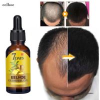 【TiTiko】eelhoe 7วั นขิง Germinal น้ำมัน Anti-Hair Loss ยาบำรุงผมสุขภาพผมบำรุงอาหารสูตรสมุนไพรเซรั่มสำหรับส่งเสริมหนาและหนาแน่น Hair Growth การเจริญเติบโตของเส้นผม เอสเซ้นส์